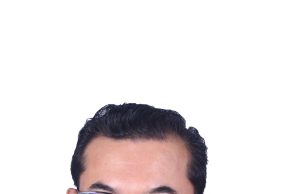 When Leg Pain Isn’t Just Ageing: Why Older Malaysians Need To Pay Attention To Vein Health